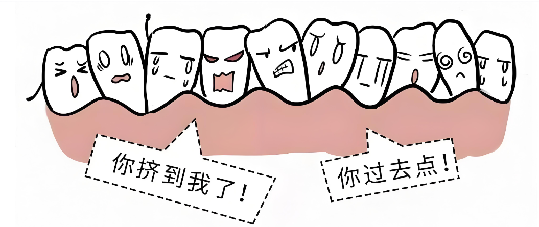 《箍牙一定要拔牙嗎？牙醫拆解哪些情況必須拔牙、哪些可以免拔》
